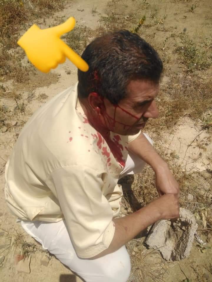 أزمة عطش خانقة تُخرج الجزائريين للاحتجاج في مظاهرة حاشدة والدرك الوطني يواجهها بالقمع (صور+فيديو) أزمة عطش خانقة تُخرج الجزائريين للاحتجاج في مظاهرة حاشدة والدرك الوطني يواجهها بالقمع (صور+فيديو)