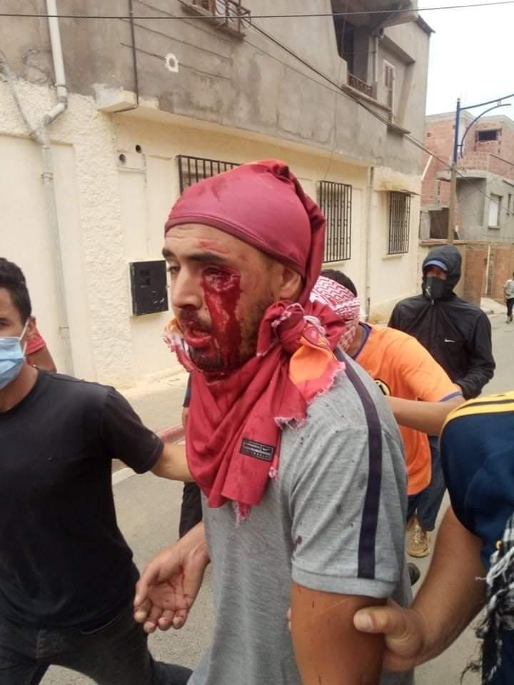 تصعيد وزحف نحو ولايات أخرى.. الحراك الشعبي يوحد كلمة الجزائريين للجمعة 120 على التوالي وبصوت واحد “لا انتخابات مع العصابات” تصعيد وزحف نحو ولايات أخرى.. الحراك الشعبي يوحد كلمة الجزائريين للجمعة 120 على التوالي وبصوت واحد “لا انتخابات مع العصابات”