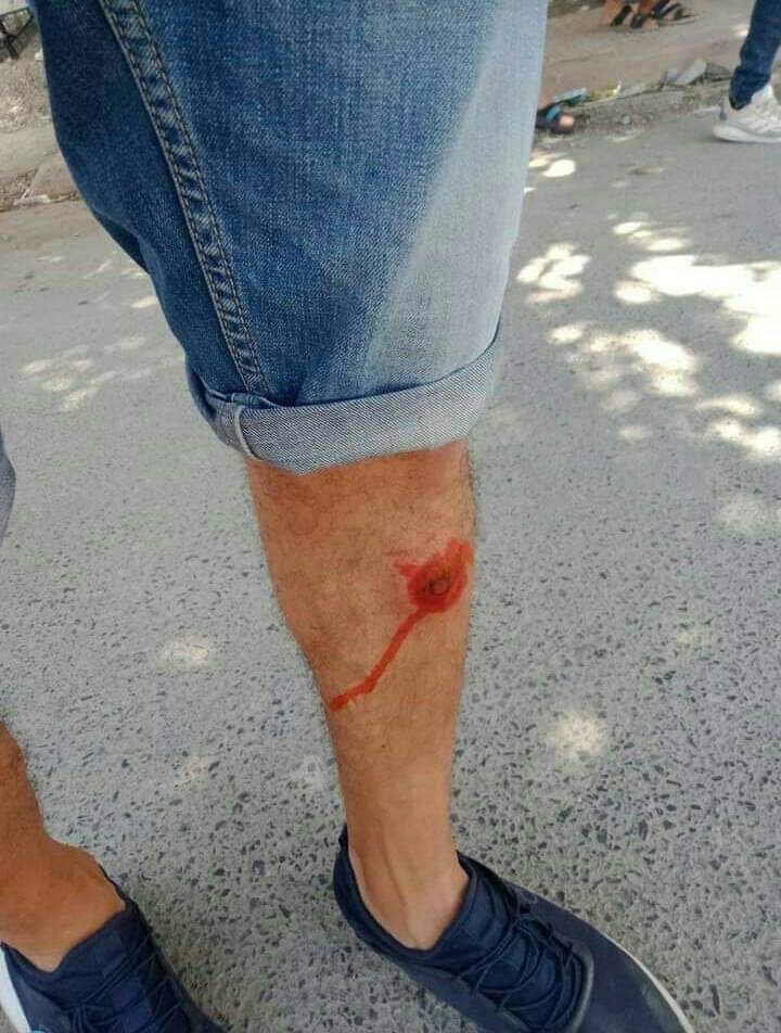 مظاهرات/ اعتقالات/ عنف ورصاص مطاطي.. الجزائريون يقاطعون الانتخابات وغضب شعبي عارم يجتاح عدة ولايات (صور+فيديو) مظاهرات/ اعتقالات/ عنف ورصاص مطاطي.. الجزائريون يقاطعون الانتخابات وغضب شعبي عارم يجتاح عدة ولايات (صور+فيديو)
