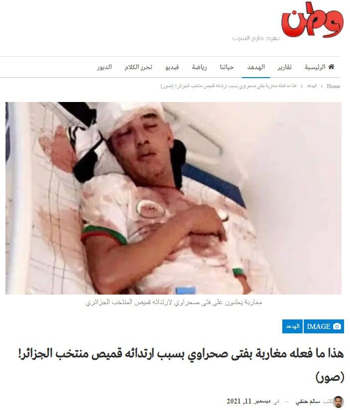 الكابرانات تروج للفايك نيوز من جديد.. فحتى وهم في حالة انتشاء بنصر كروي لا يستطيعون نسيان المغرب (صور) الكابرانات تروج للفايك نيوز من جديد.. فحتى وهم في حالة انتشاء بنصر كروي لا يستطيعون نسيان المغرب (صور)