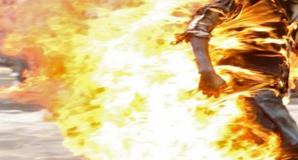 بسبب خلافاته الزوجية.. شخص يضرم النار في جسده بإقليم سطات 1 شخص يضرم النار